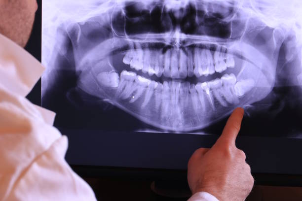 Best Holiday Emergency Dentist in Newberry, MI